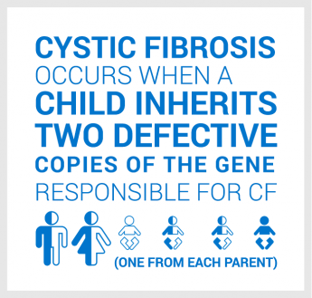 Cystic fibrosis occurs when a child inherits two defective copies of the gene responsible for cystic fibrosis (one from each parent).
