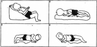 Postural drainage and percussion (PD&P), also commonly known as chest physiotherapy